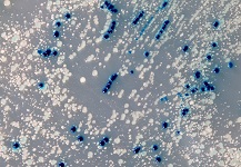 Plasmid DNA isolation